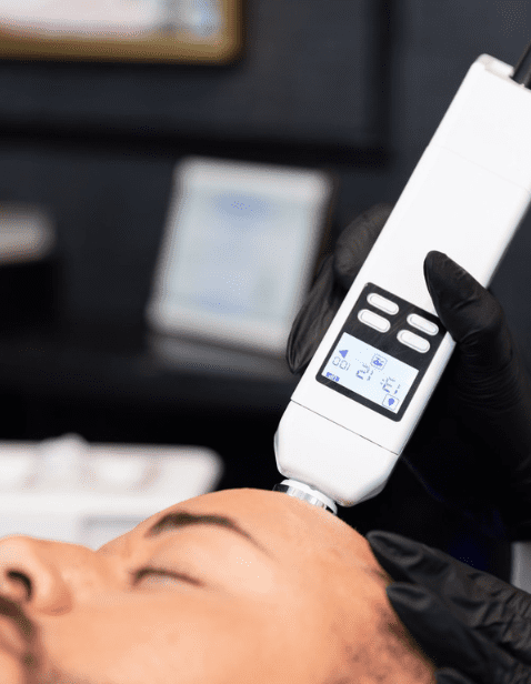 A professional wearing black gloves using a handheld device for DE|RIVE Hair Support treatment on a man's scalp.