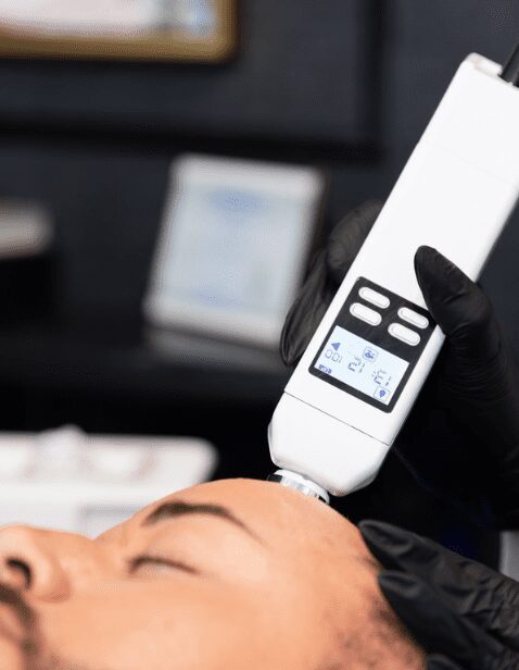 A professional wearing black gloves using a handheld device for DE|RIVE Hair Support treatment on a man's scalp.