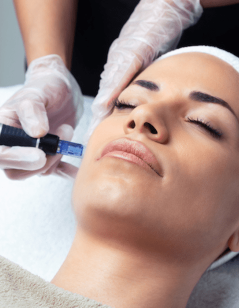 Microdermabrasion (1)